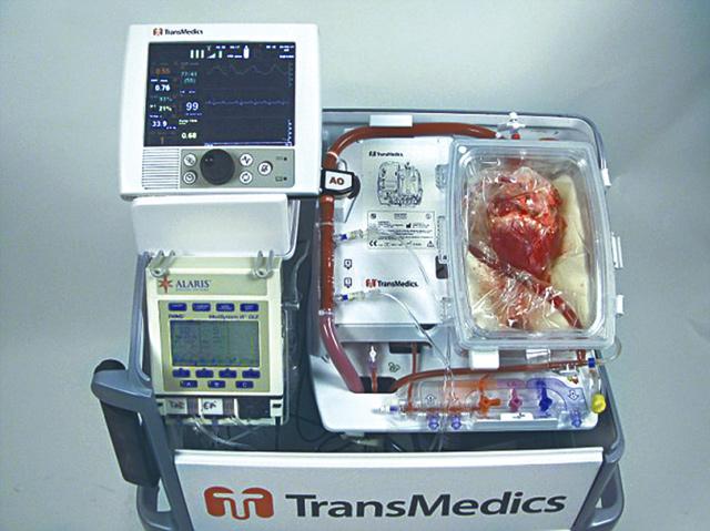 醫生利用「生物體以外器官保存系統」儀器保存心臟。
