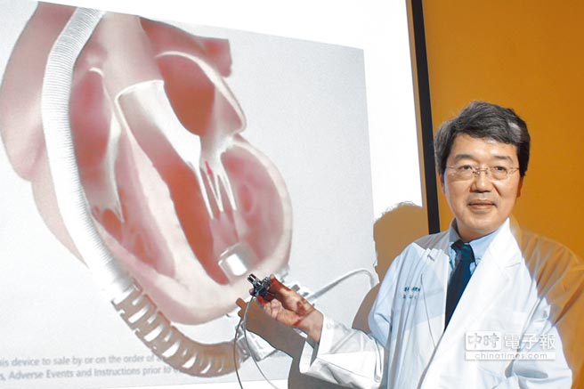 中醫大附設醫院心臟外科主任李秉純指出，新式人工心室輔助器體積小，縫合在心尖後穿入左心室，像幫浦(泵)般抽左心室的血，再以人工血管輸送到主動脈。（馮惠宜攝）