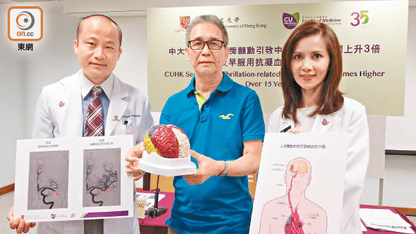 中大醫學院發布研究結果,發現七成房顫病人中風前無接受抗凝血藥治療。左起:中大內科及藥物治療學系腦神經學副教授梁慧康、病人駱先生、蘇藹欣。(關琛詩攝)