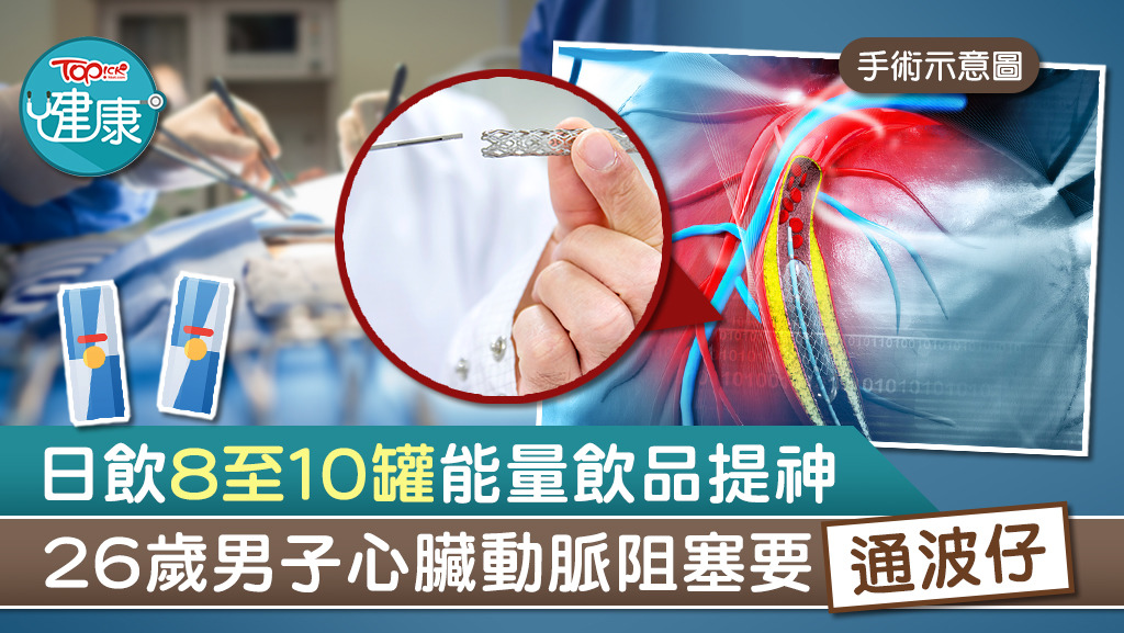 ▲ 西班牙一名26歲男子每天喝8至10罐能量飲品，繼而引發心臟病。
