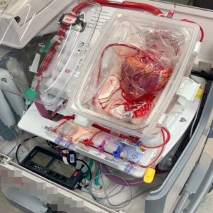 心臟移到器官護養系統後，會維持跳動。（瑪麗醫院提供圖片）
