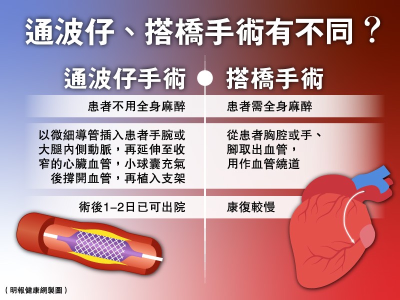 通波仔和搭橋手術兩者有何分別?患者在手術後的康復進度又有什麼不同呢?