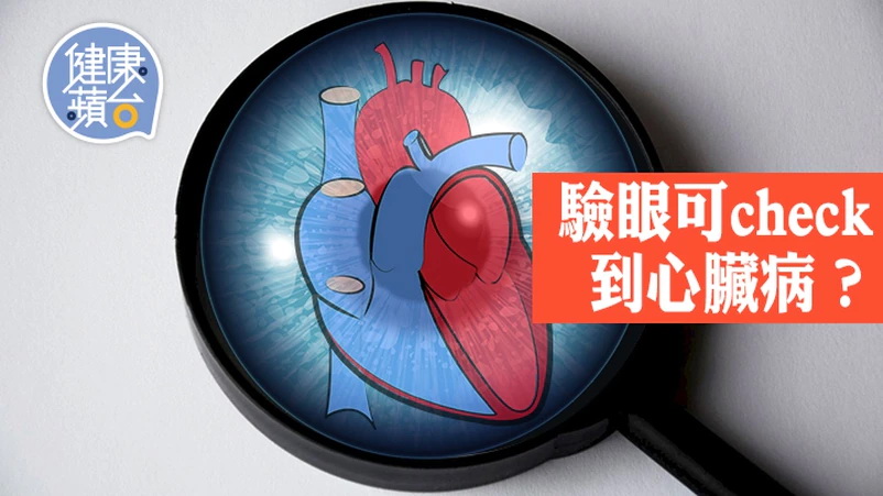 研究指透過觀察視網膜的狀況，有助了解心臟健康問題。
