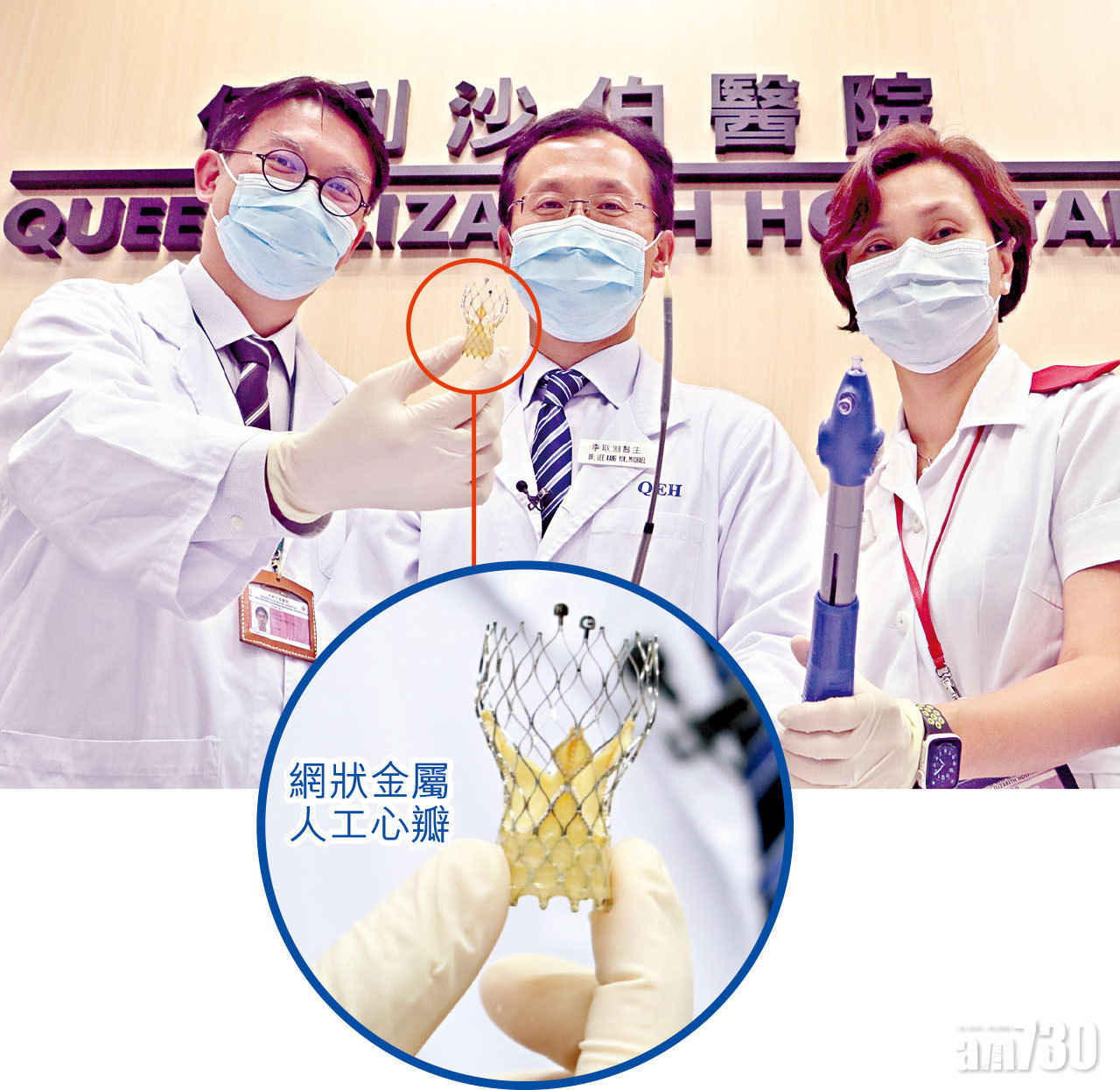 醫療解碼 嚴重主動脈瓣狹窄不宜開胸 改做TAVI增存活率