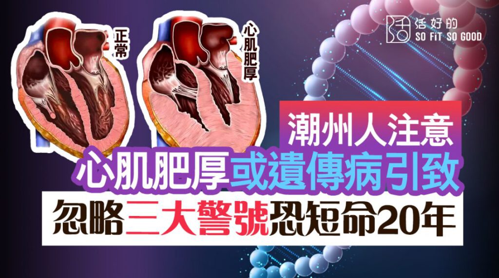 【潮州人注意】心肌肥厚或遺傳病引致 忽略三大警號恐短命20年